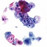 Exame Colpocitológico