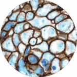 Exame Imuno-Histoquímico