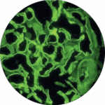 Imunofluescência Direta