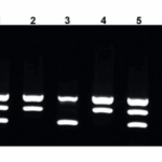Reação em Cadeia de Polimerase (PCR) em Doenças Infecciosas