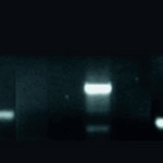 Reação em Cadeia de Polimerase em Tempo Real (RT-PCR)