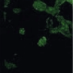 Sequenciamento Direto